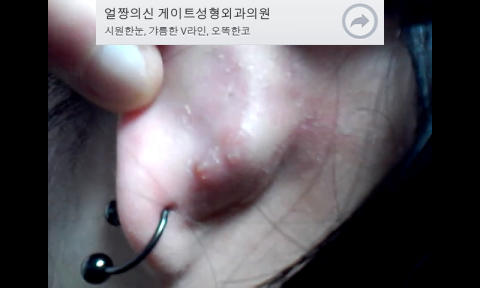 귀뒤에 여드름도 아닌게 오돌토돌한데 어떡해야 업어지나요? 귀뒤에 여드름도 아닌게 오돌토돌한데 어떡해야 업어지나요?