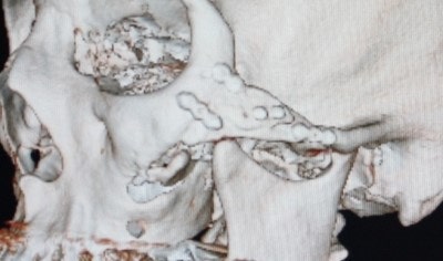 ÷ºÎ À̹ÌÁö