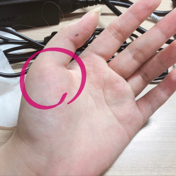 엄지손가락 관절통증 : 지식In