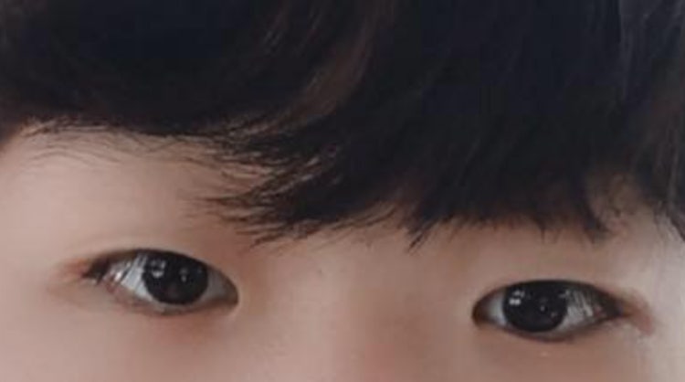 남자 속쌍 질문이요~ : 지식iN