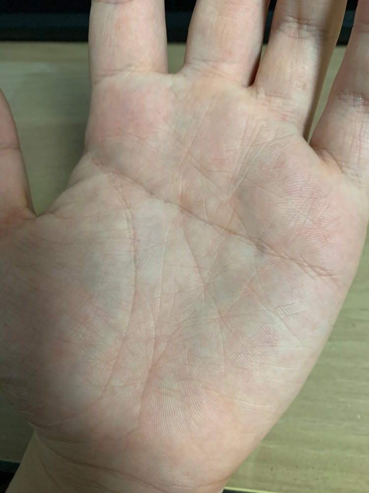 막쥔손금(일자손금) 봐주세요. 내공2700 : 지식In