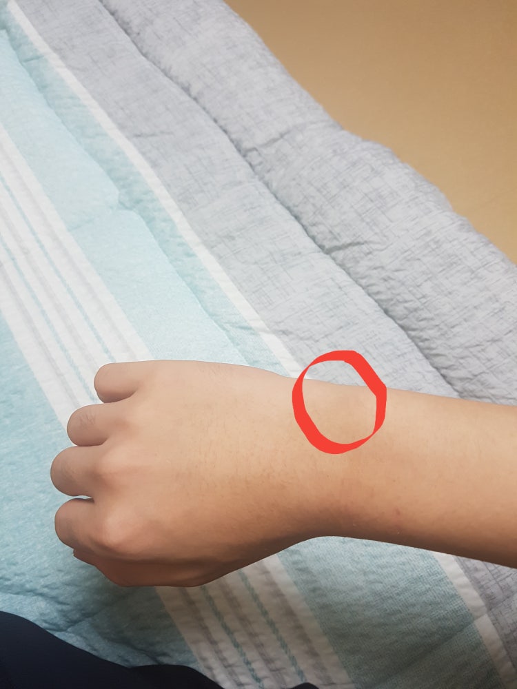 새끼손가락쪽 손목에 통증이 있습니다. 내공100 : 지식iN 새끼손가락쪽 손목에 통증이 있습니다. 내공100 : 지식In