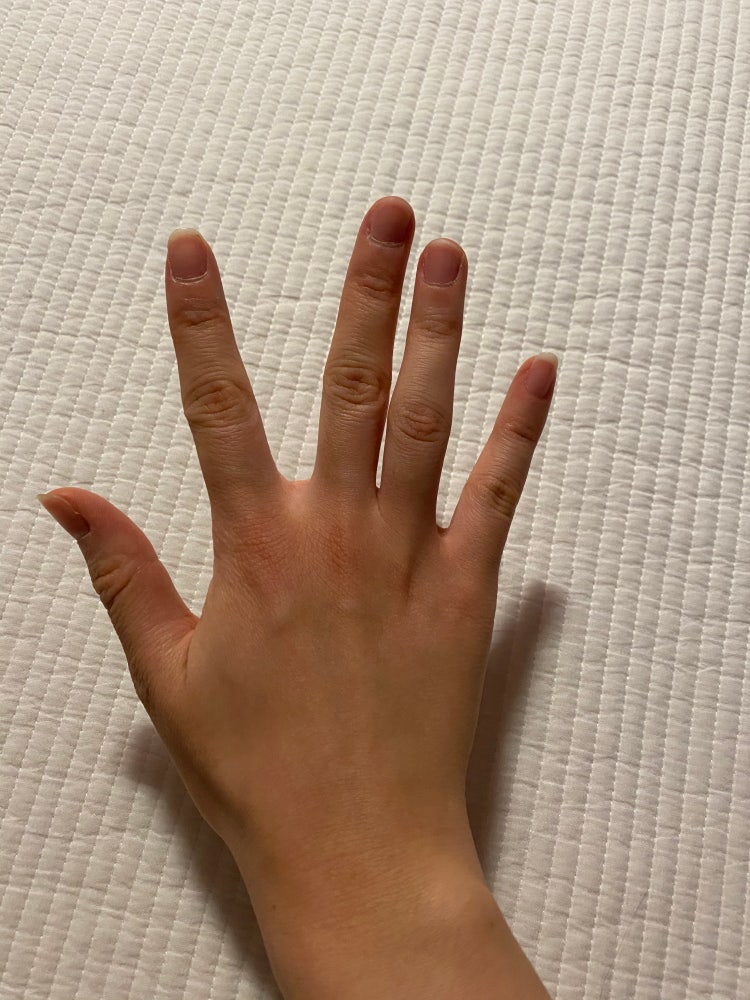 손가락이 잘 안펴져요 : 지식In