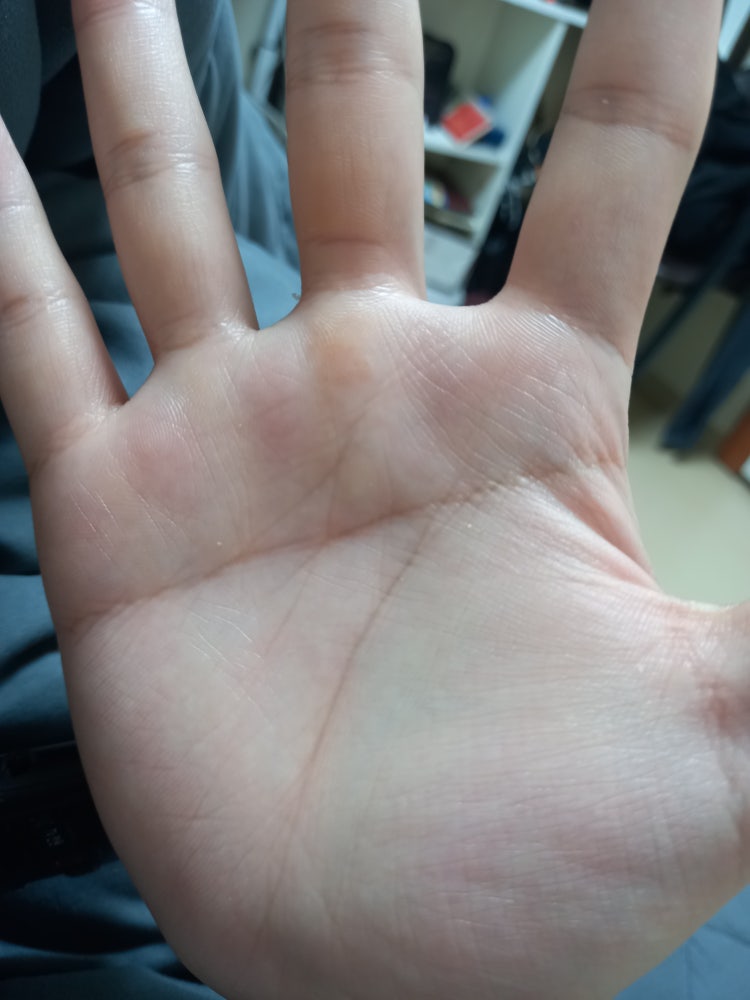 남자 오른손 일자손금 질문 : 지식In
