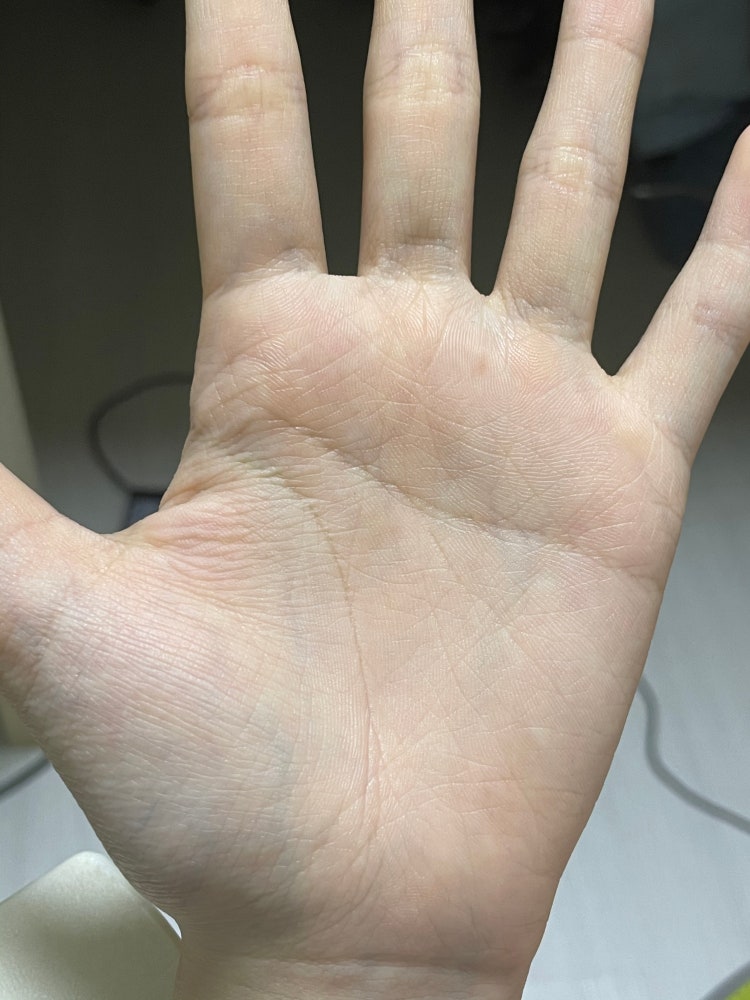 애들이랑 손금이 달라서...(일자손금) : 지식In