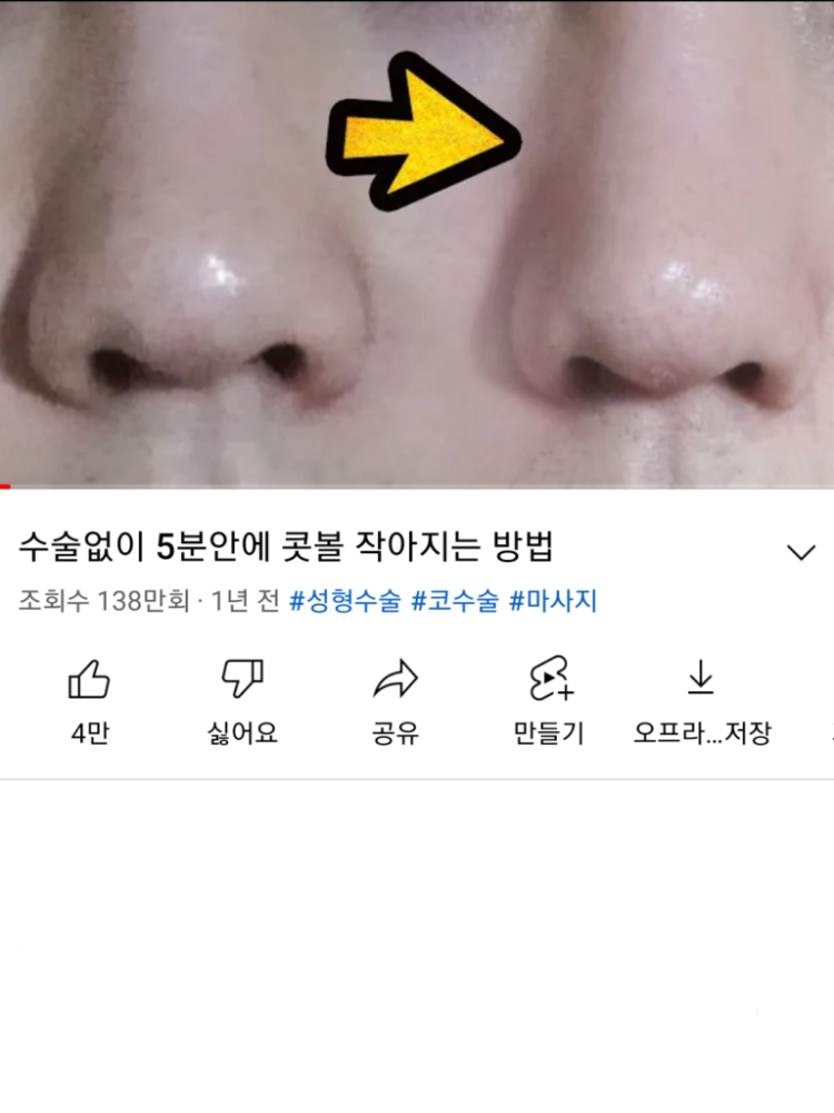 콧볼 작아지는법 : 지식In