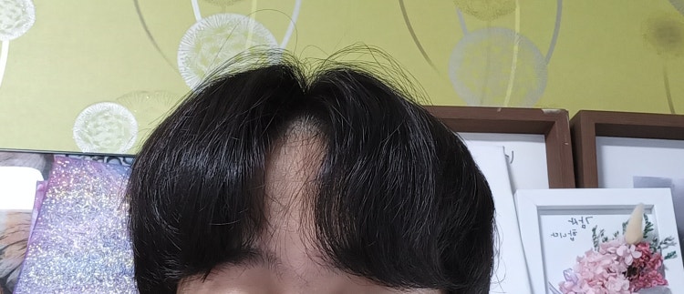 애즈펌 손질 : 지식In