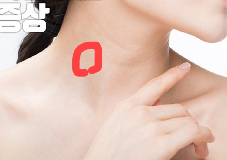 목 오른쪽아래 통증 : 지식iN 목 오른쪽아래 통증 : 지식In