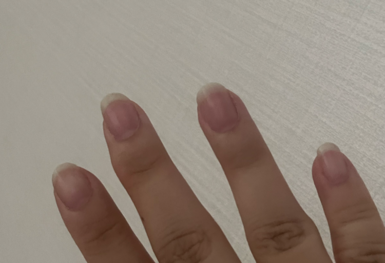 중지손가락 굳은살 없애는법 : 지식iN 중지손가락 굳은살 없애는법 : 지식In