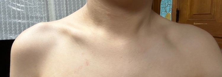 제 쇄골이 상견, 중견, 하견인지 궁금합니다 : 지식iN