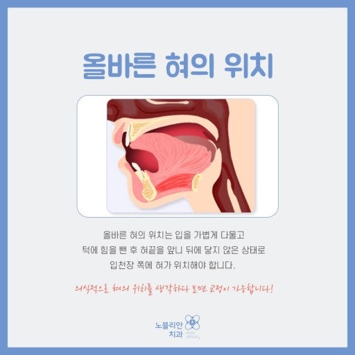 올바른 혀 위치 : 지식iN