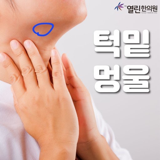턱 밑 멍울에 대하여 : 지식iN