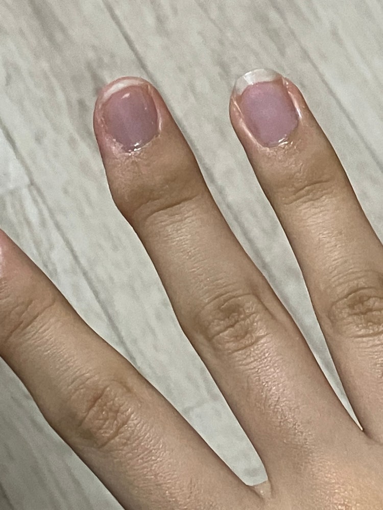 중지손가락 굳은살 없애는법 : 지식iN 중지손가락 굳은살 없애는법 : 지식In
