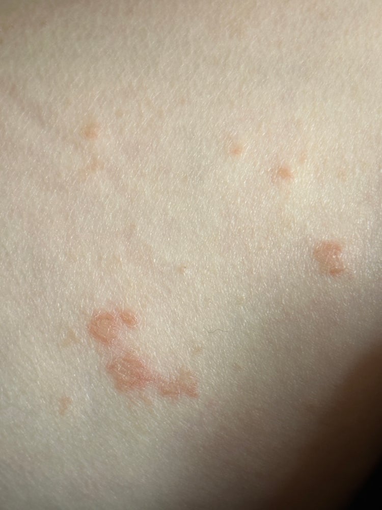 성병 피부인지 봐주세요 급해요….. : 지식In