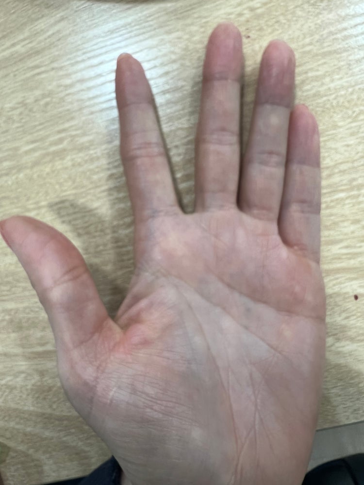 여자 오른쪽 일자 왼쪽 손금 점 봐 주세요~ : 지식In