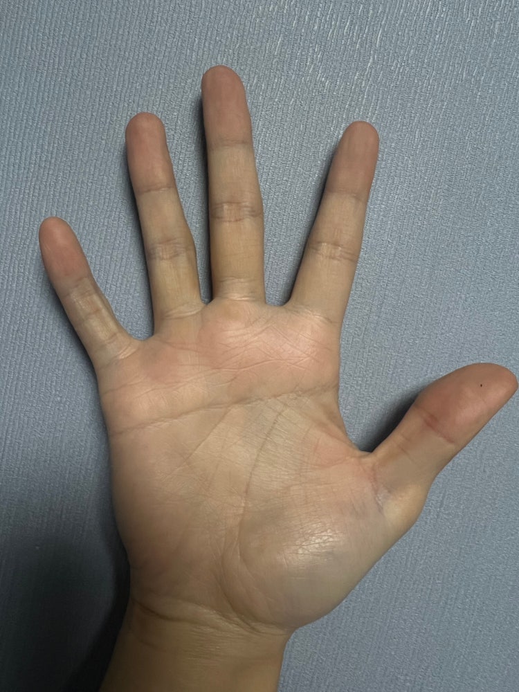 이거 일자손금 맞지요?? : 지식In