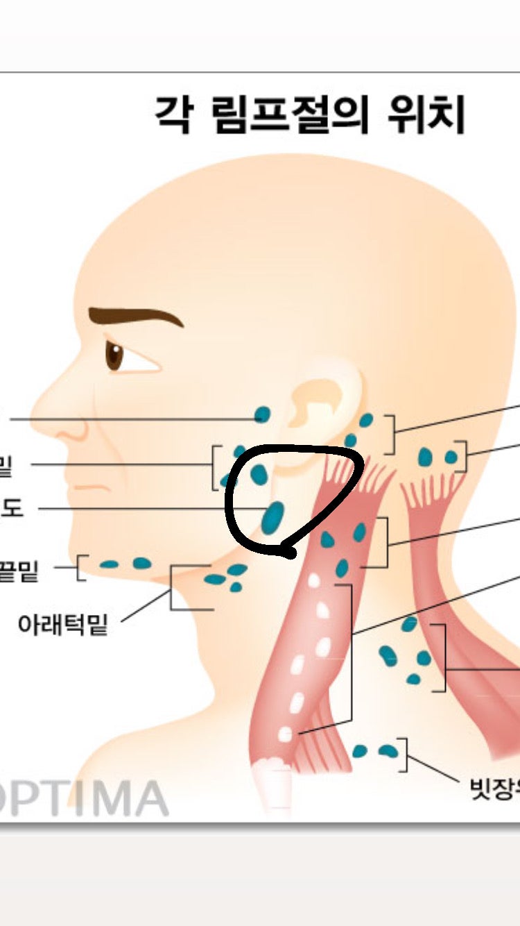 오른쪽 귀 밑 턱 부움 : 지식iN
