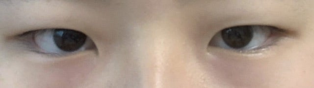 속쌍쌍수 궁굼한점 : 지식iN