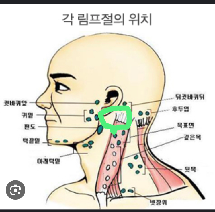 귀뒤 멍울? 질문 : 지식iN