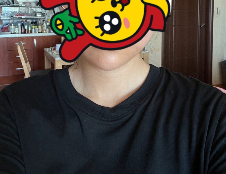 턱끝필러 ㅜ : 지식iN