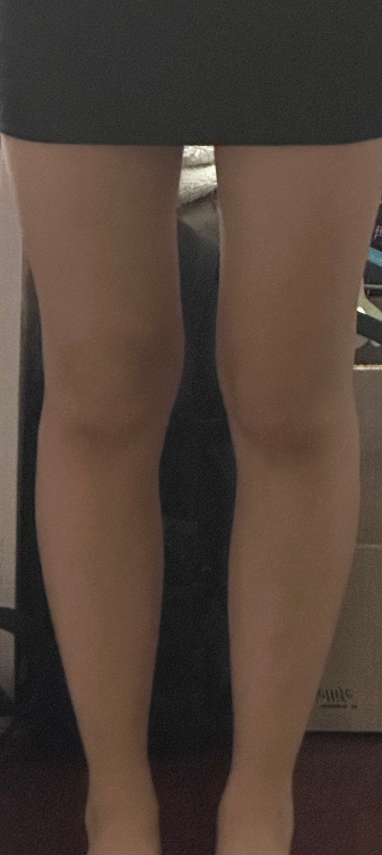 O자다리는 아닌데 종아리가 휘었는데 일자다리 지식iN