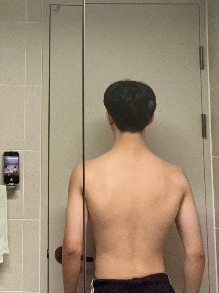 하견 어깨 질문 : 지식iN