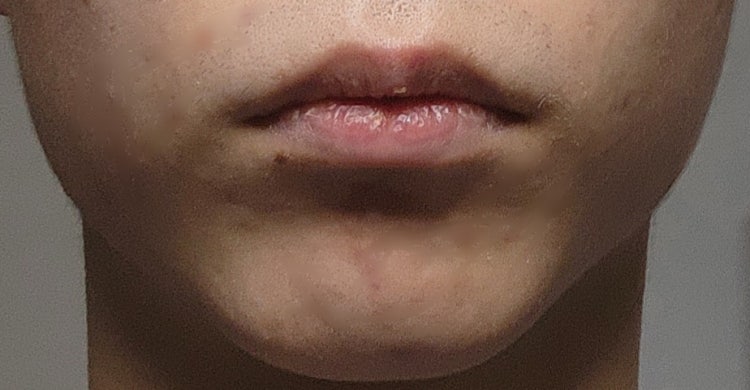 턱 : 지식iN
