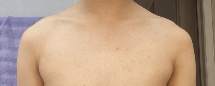 어깨 상견 중견 하견 중 어떤거인가요? : 지식iN