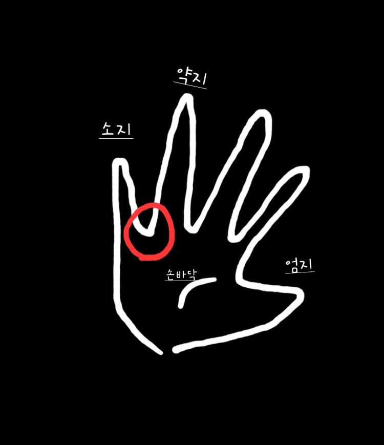 약지손가락 새끼손가락 사이 손바닥 불편함(그림참고) : 지식iN