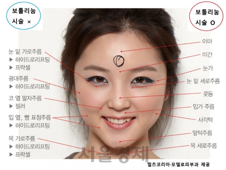 미간쪽에 뼈 있나요?? : 지식iN
