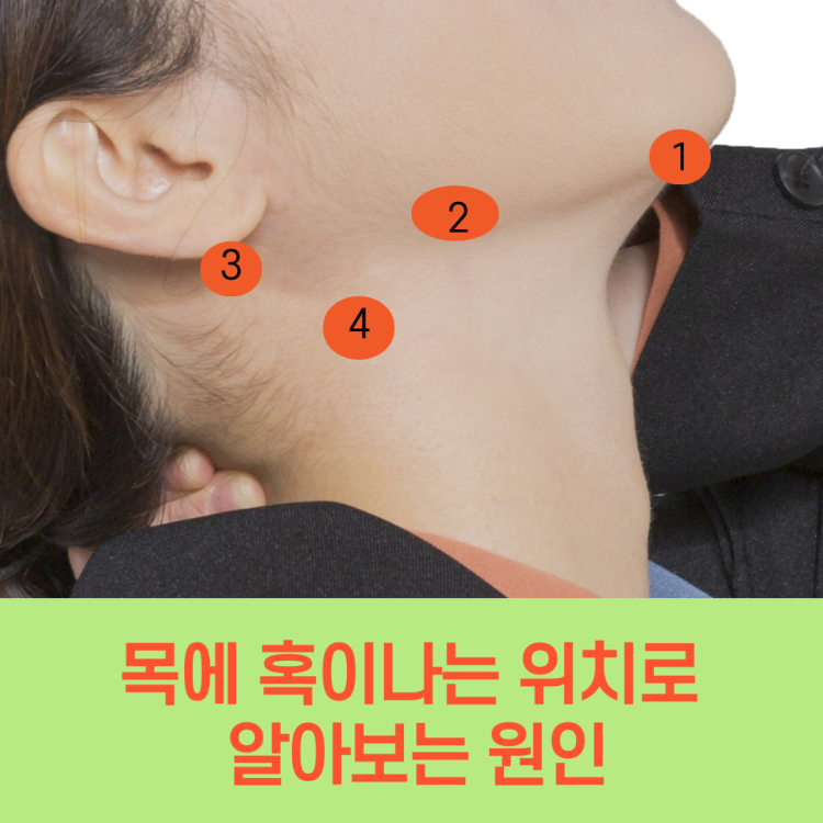 턱 밑에 ①부분이 부은 느낌이 들고 누르면 아파요 : 지식iN