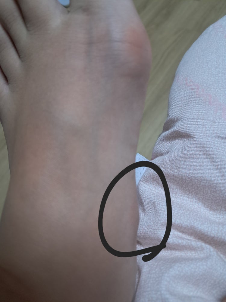 발 뼈가 계속 지끈거리는데 뭔가요? : 네이버 지식iN