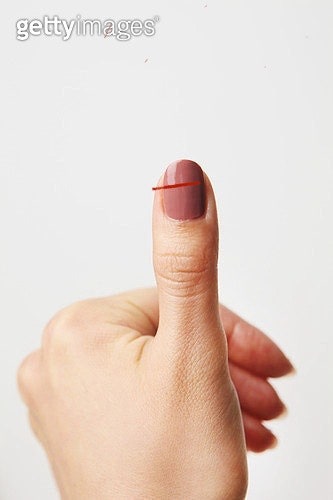 손가락 깊은 자상 : 지식iN