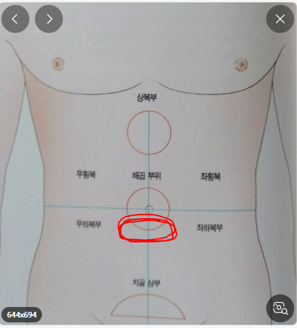 배꼽 아래 통증 : 지식iN