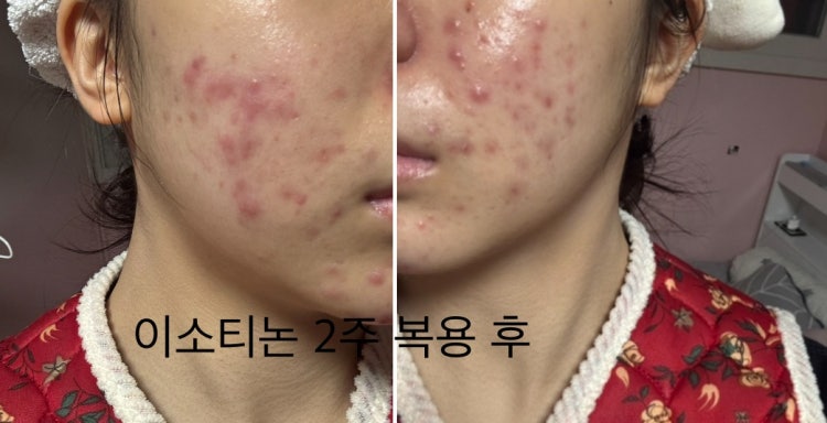 제발도와주세요ㅠㅜ : 지식iN